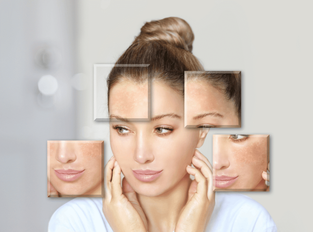 Điều trị da cá nhân hóa – Làm chủ làn da khỏe mạnh từ gốc tại Dilys Aesthetic Clinic