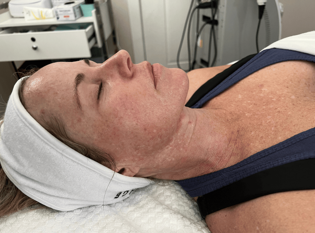 Điều trị da cá nhân hóa – Làm chủ làn da khỏe mạnh từ gốc tại Dilys Aesthetic Clinic