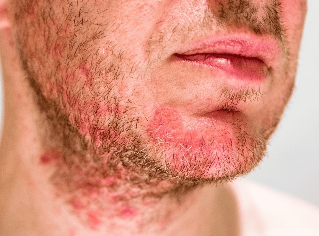 Điều trị da cá nhân hóa – Làm chủ làn da khỏe mạnh từ gốc tại Dilys Aesthetic Clinic