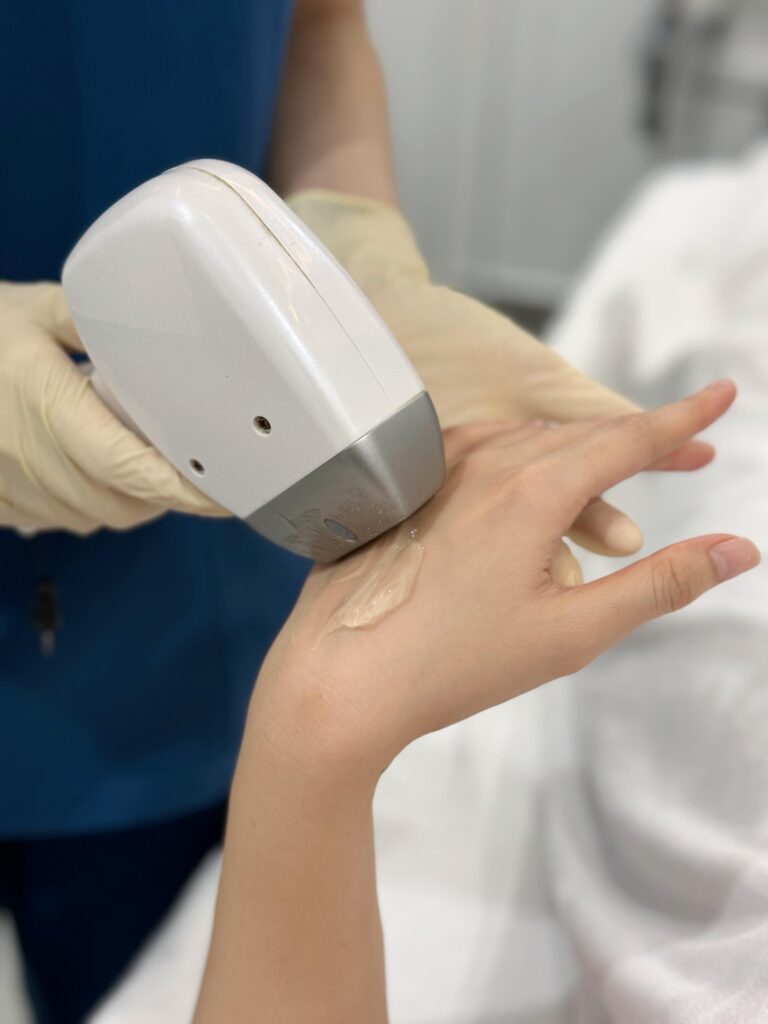 Triệt Lông Không Chỉ Là Làm Mịn – Mà Là Làm Đẹp Da Từ Gốc Tại Dilys Aesthetic Clinic