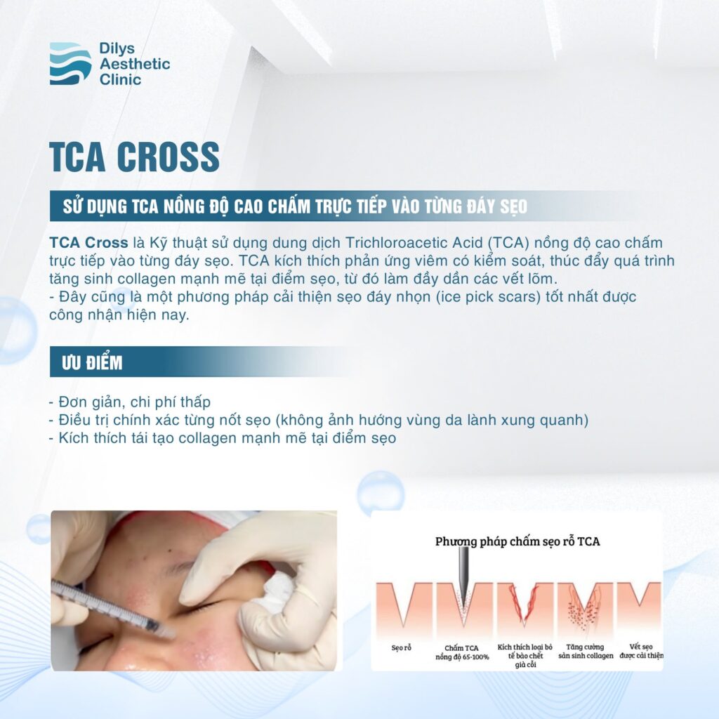 cham-tca-cross-dieu-tri-seo-day-nhon-ice-pick